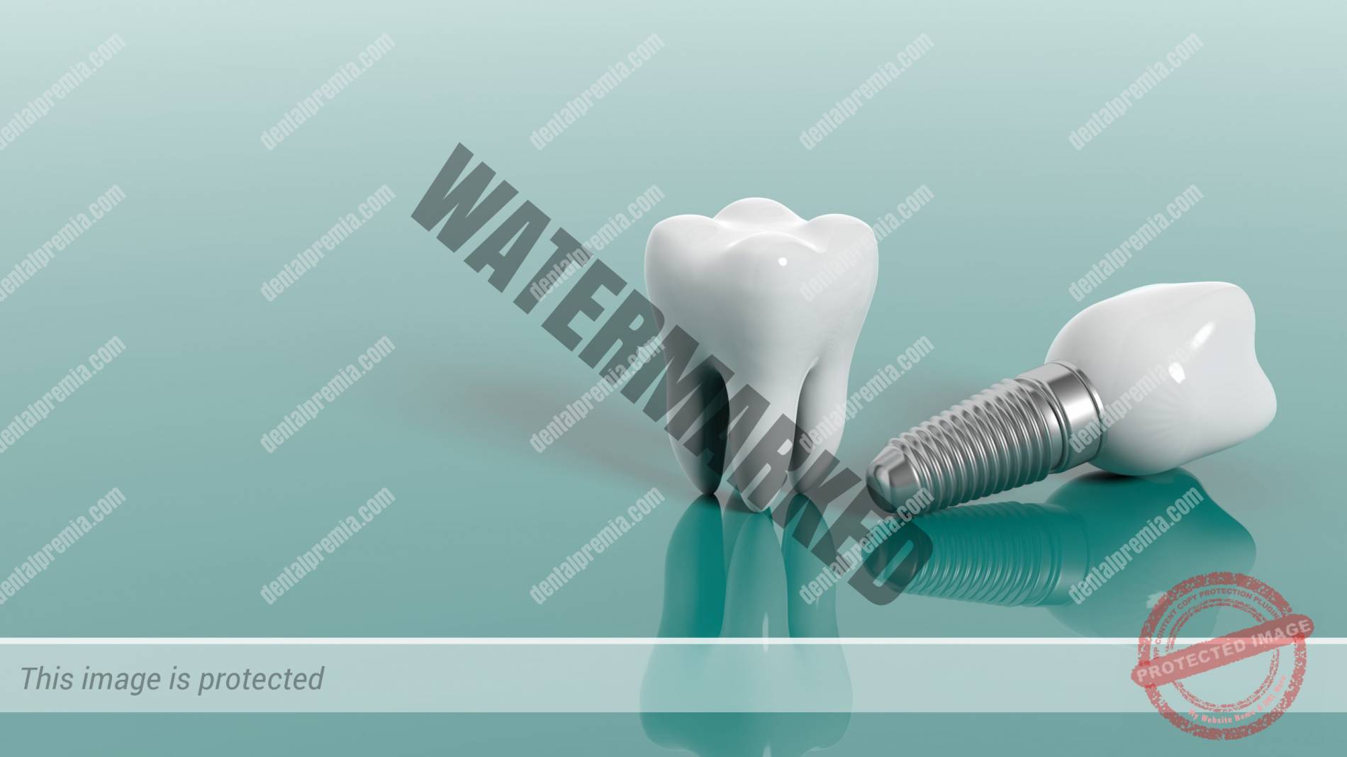 imagen de implantes dentales clinica dental premià