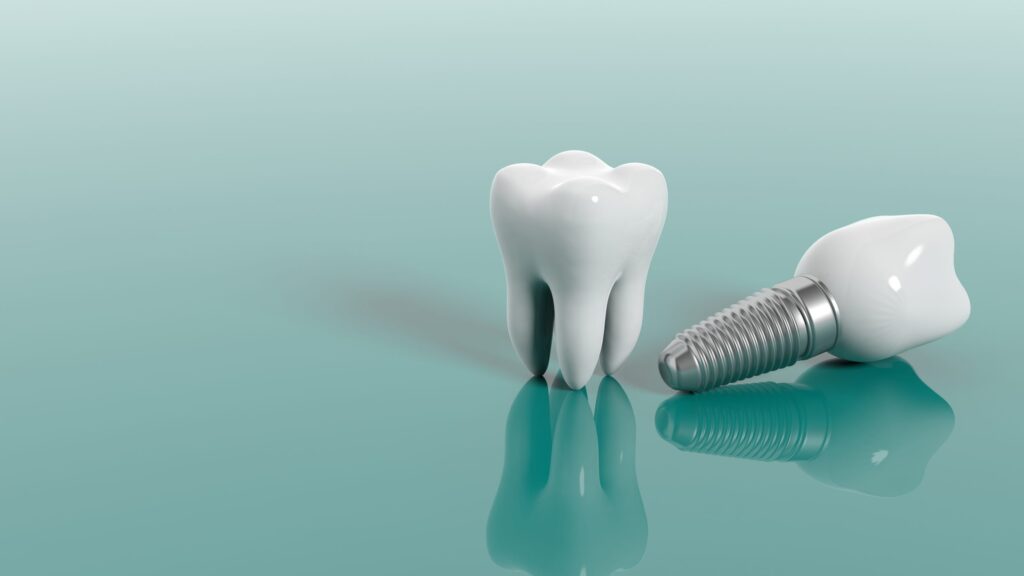 Tratamiento: implantes dentales
