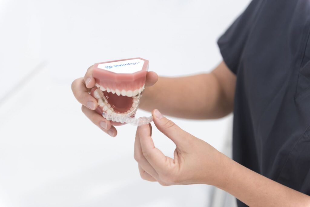 Invisalign, ortodoncia invisible, cómoda e higiénica