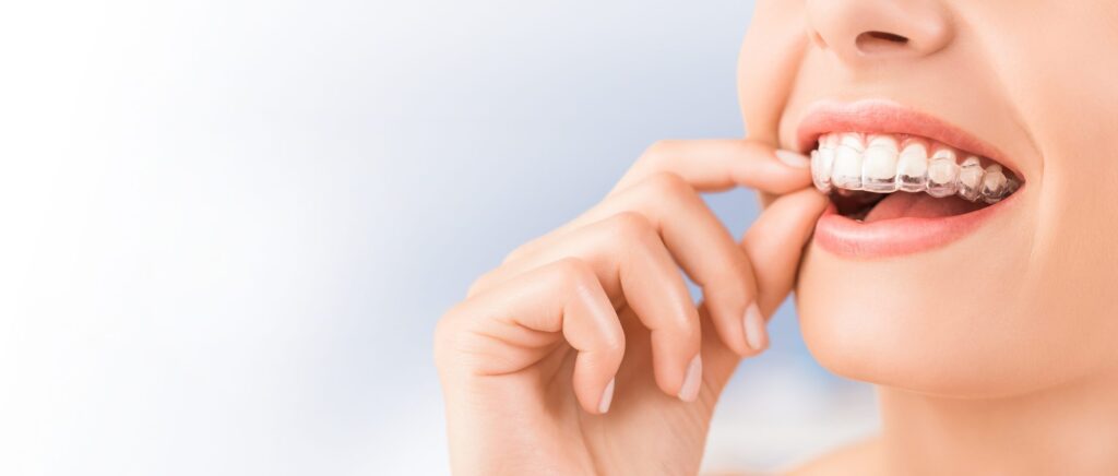 Ortodoncia invisible con Invisalign en Dental Premià, Barcelona