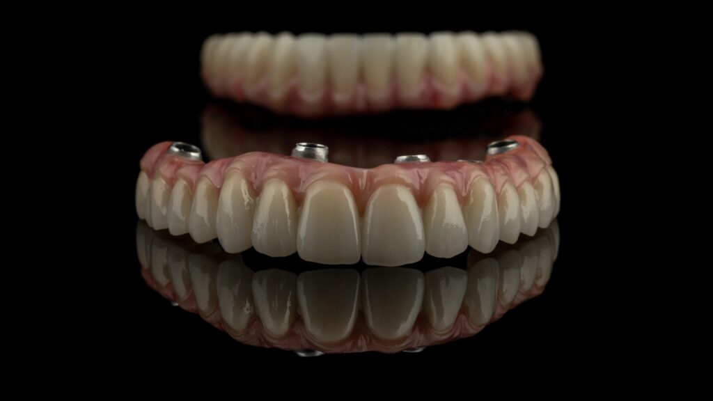 Rehabilitación y prótesis dental en Barcelona