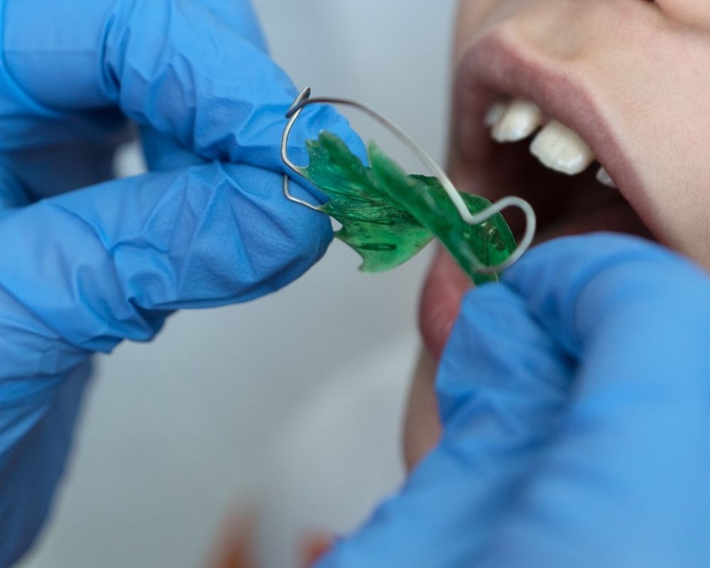 Ortodoncia infantil, aparatos en los dientes para niños y niñas en Dental Premià, Barcelona