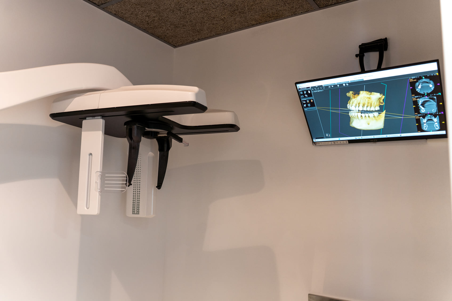 Sala de CBCT, OPG y TLC en Premià de Dalt, Barcelona